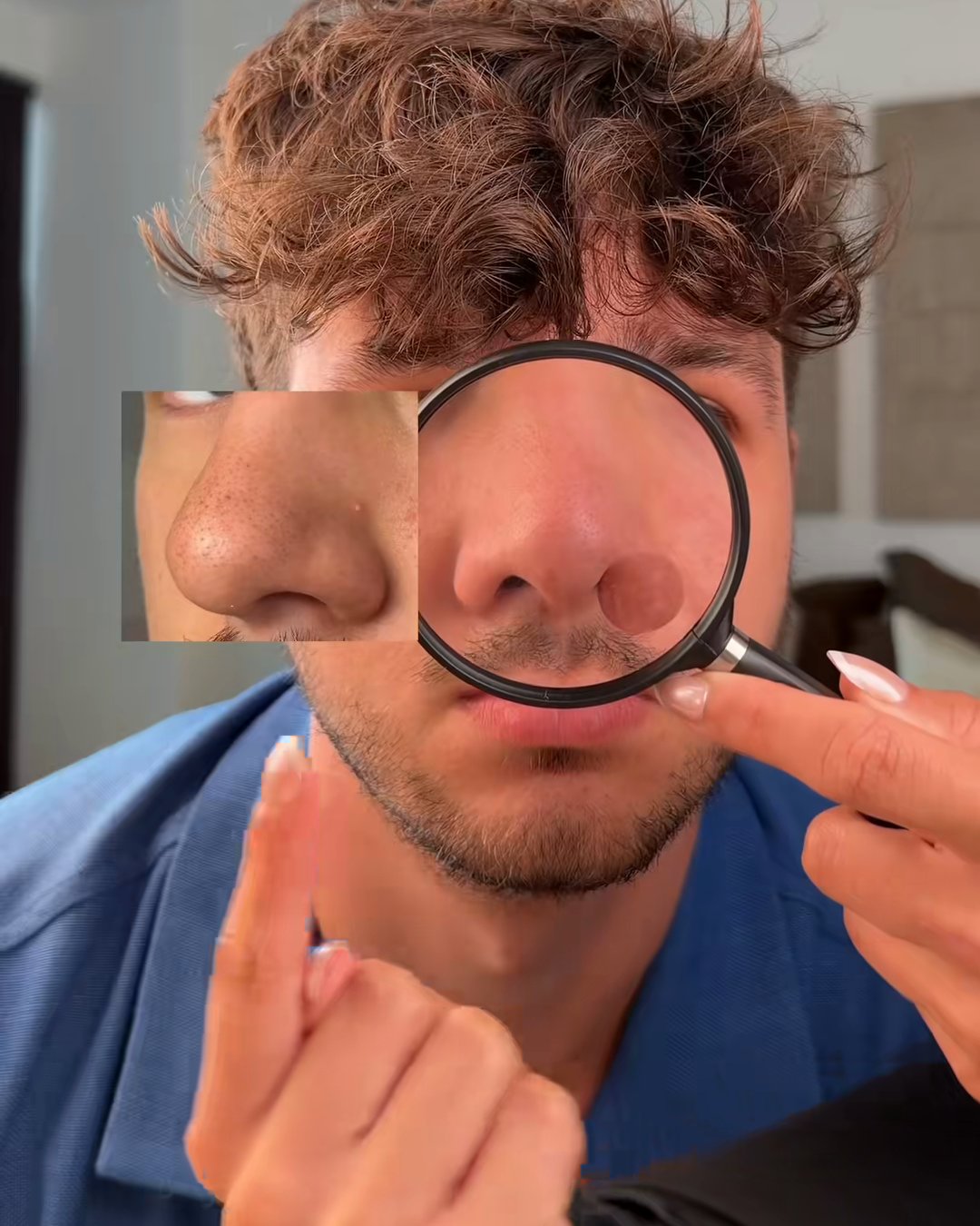 His nose before: My husband's nose before and after one use of the clay (SKIN1004 Poremizing Clay Stick Mask, Aerely Chacón)
